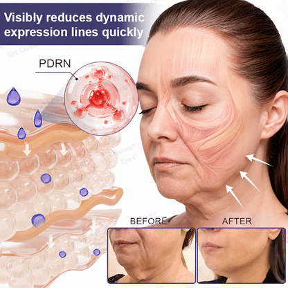 💄✨Celsiora® PDRN Renewal Complex Eye Cream | Wrinkles, Puffiness & Dark Circles